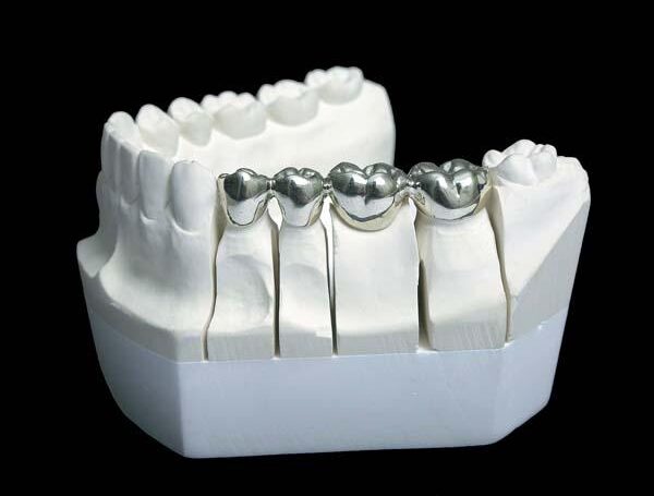 Raed launches a campaign to get rid of “amalgam”, the deadly mercury dental filling